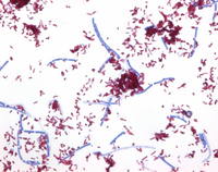 TB-COLOR MODIFIED STAINING KIT FOR THE D